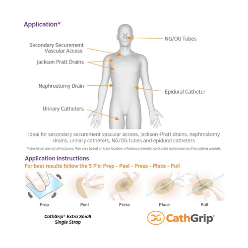 CathGrip® Extra Small Tube Securement Device (Single Strap, Non-Sterile)