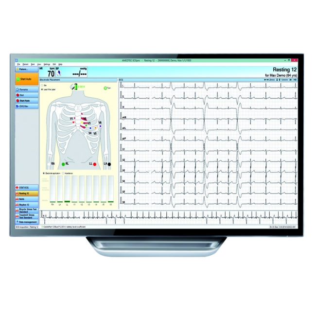 AMEDTEC ECGpro CardioPart 12 PC-Based ECG 12 Channel